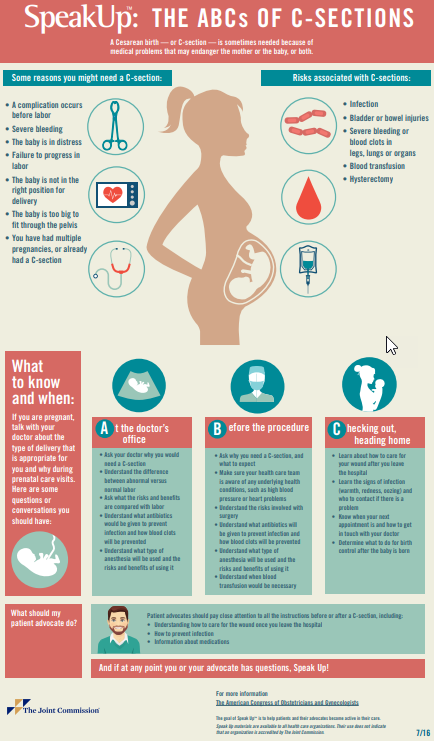ABC's of C-Sections infographic